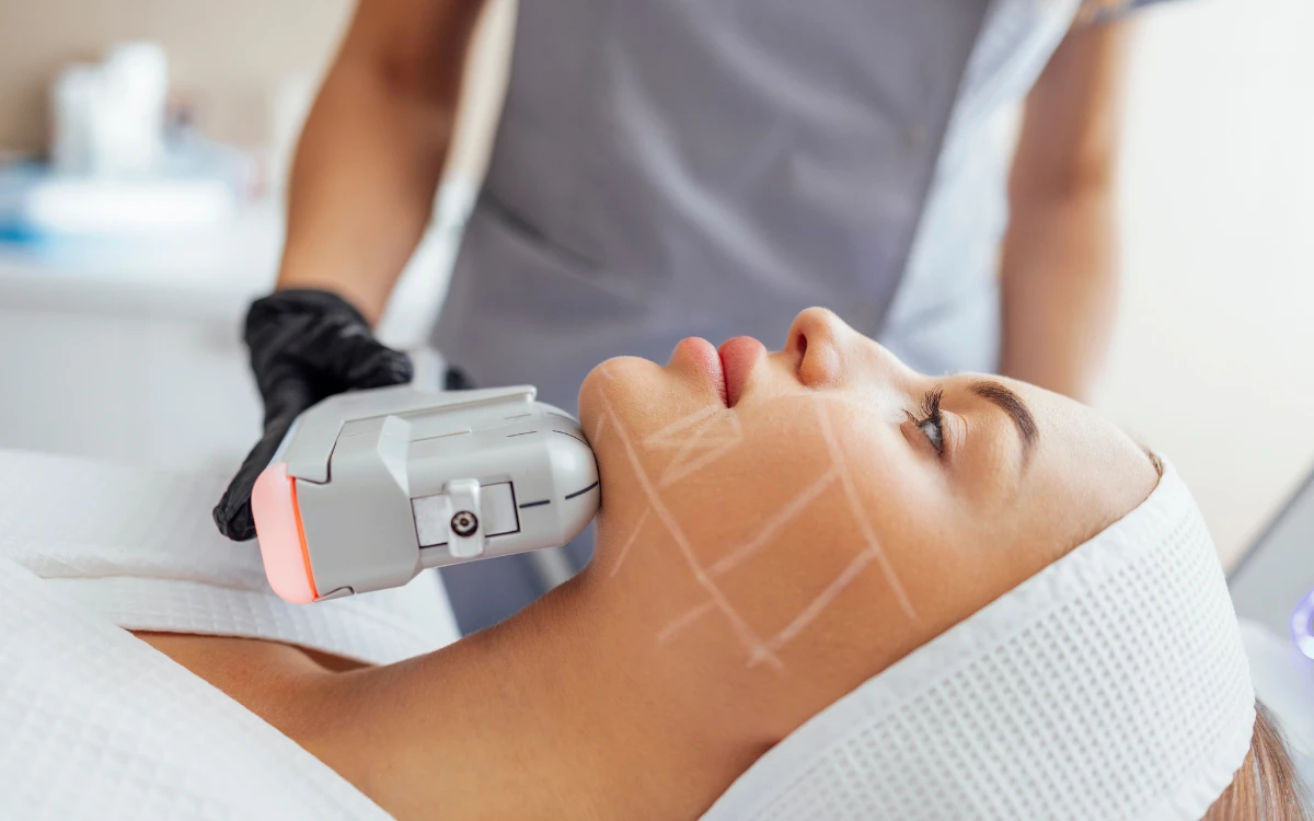 Todo-lo-que-debes-saber-sobre-el-HIFU-facial-y-corporal